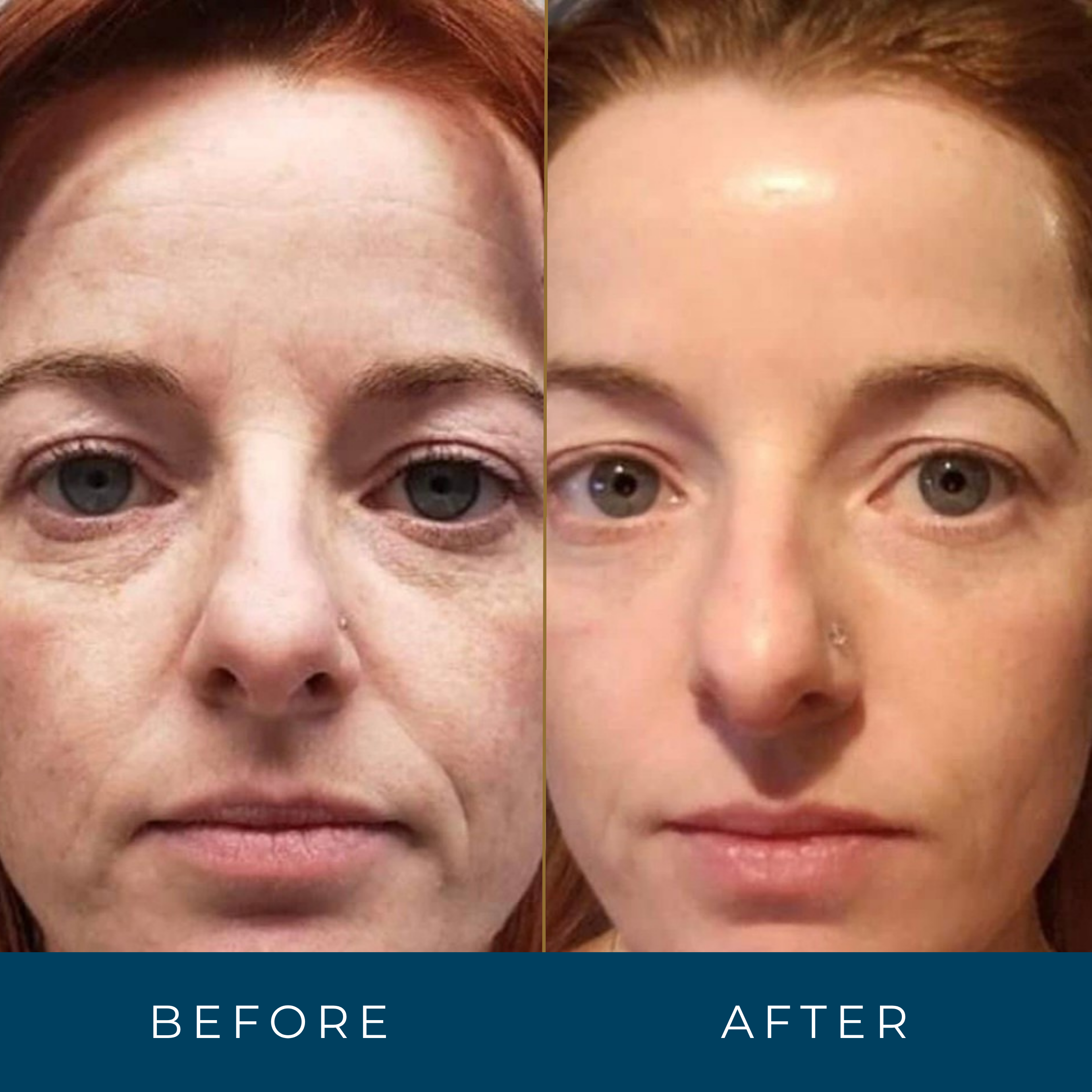 Retinal Face Serum Anti-Aging Vitamin A Wrinkle Reducer