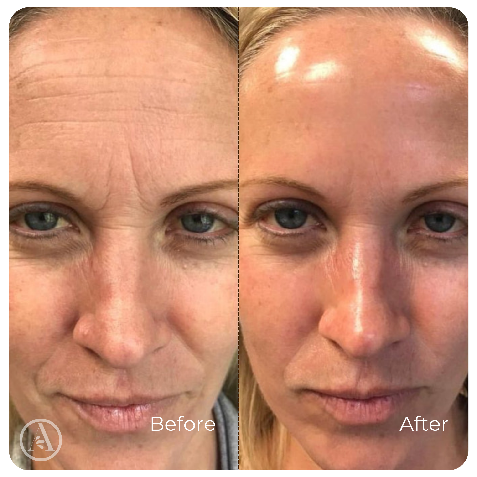Collagen Serum Wrinkle Smoothing Anti-Aging Face Treatment