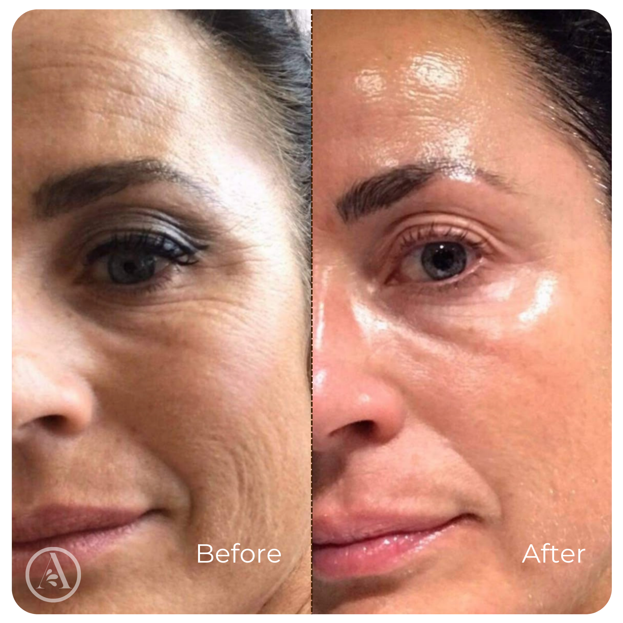 Collagen Serum Wrinkle Smoothing Anti-Aging Face Treatment