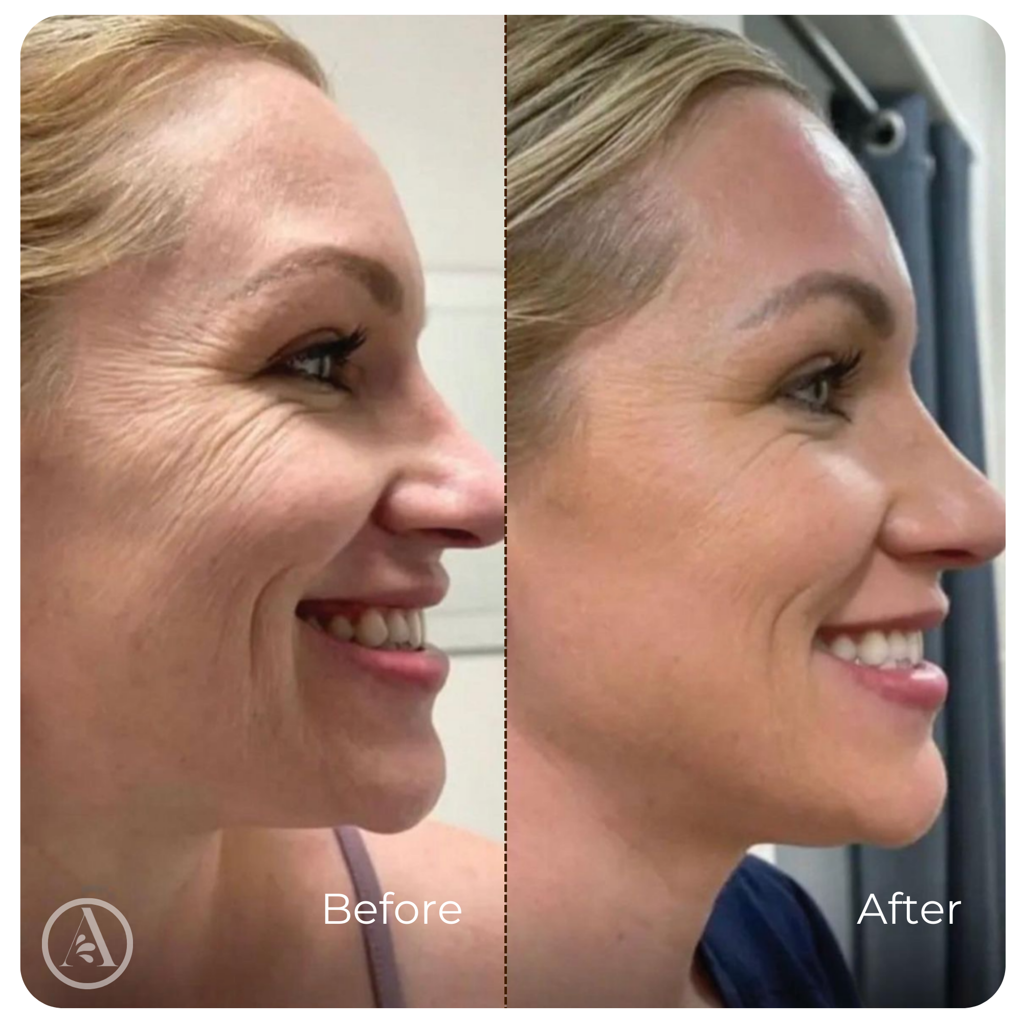 Collagen Serum Wrinkle Smoothing Anti-Aging Face Treatment