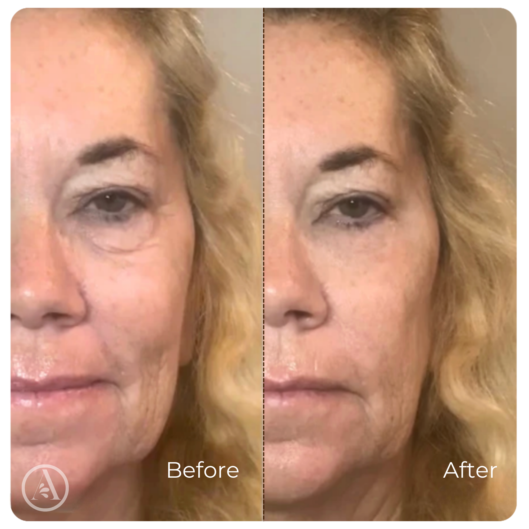 Collagen Serum Wrinkle Smoothing Anti-Aging Face Treatment