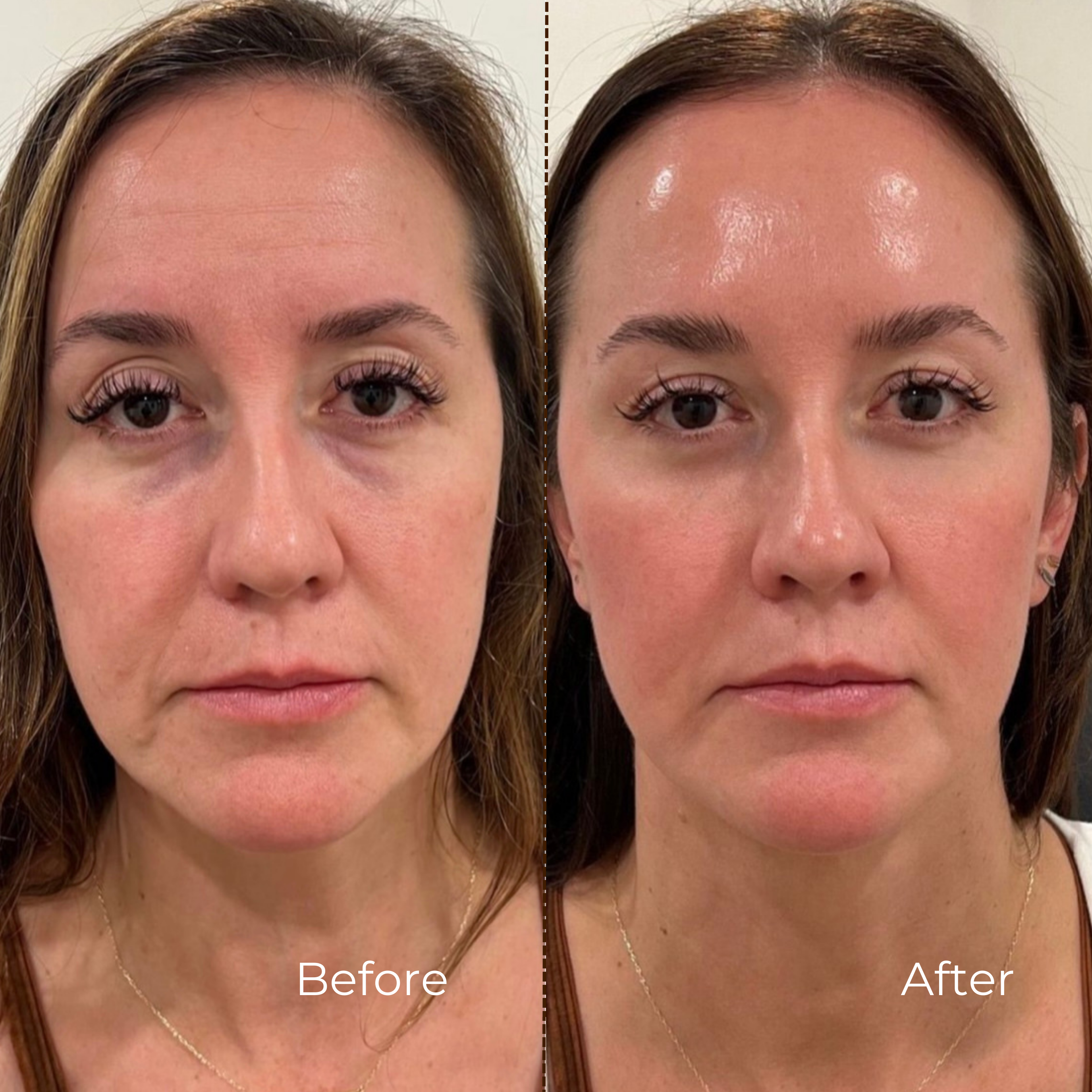 AlpaSkin™ Collagen Lift Cream-Serum