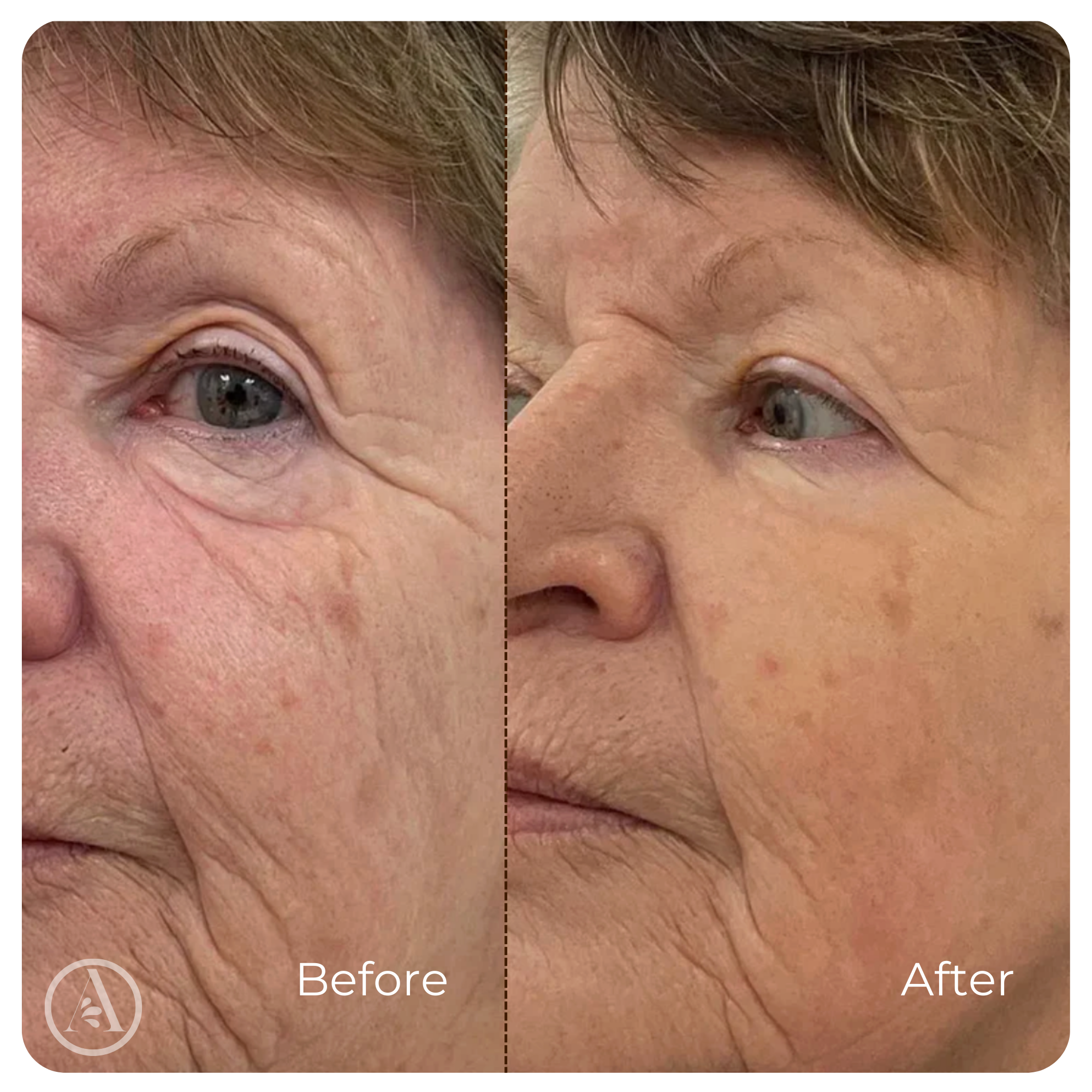 Collagen Serum Wrinkle Smoothing Anti-Aging Face Treatment