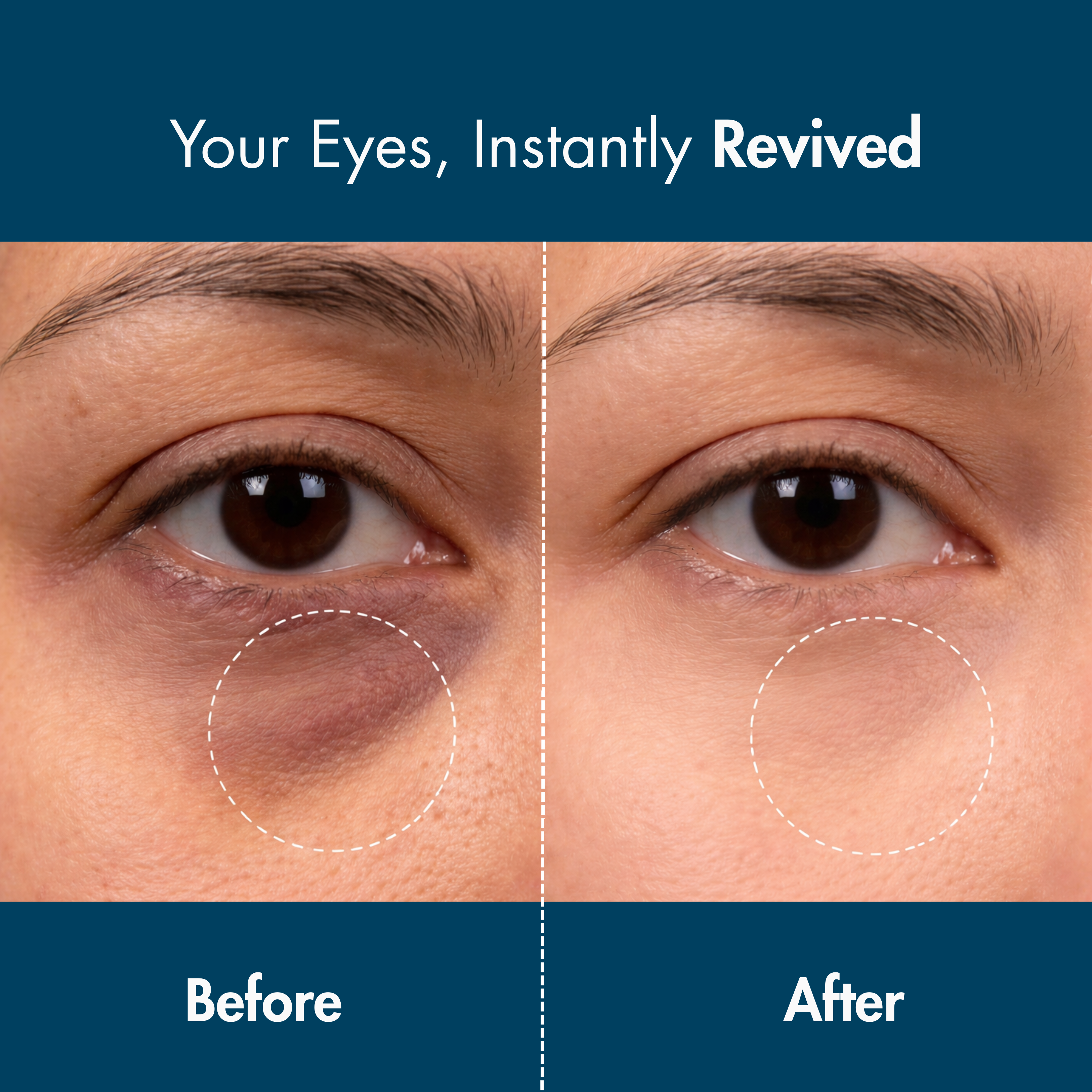 Alpaskin™ Bright Eyes LED Patches