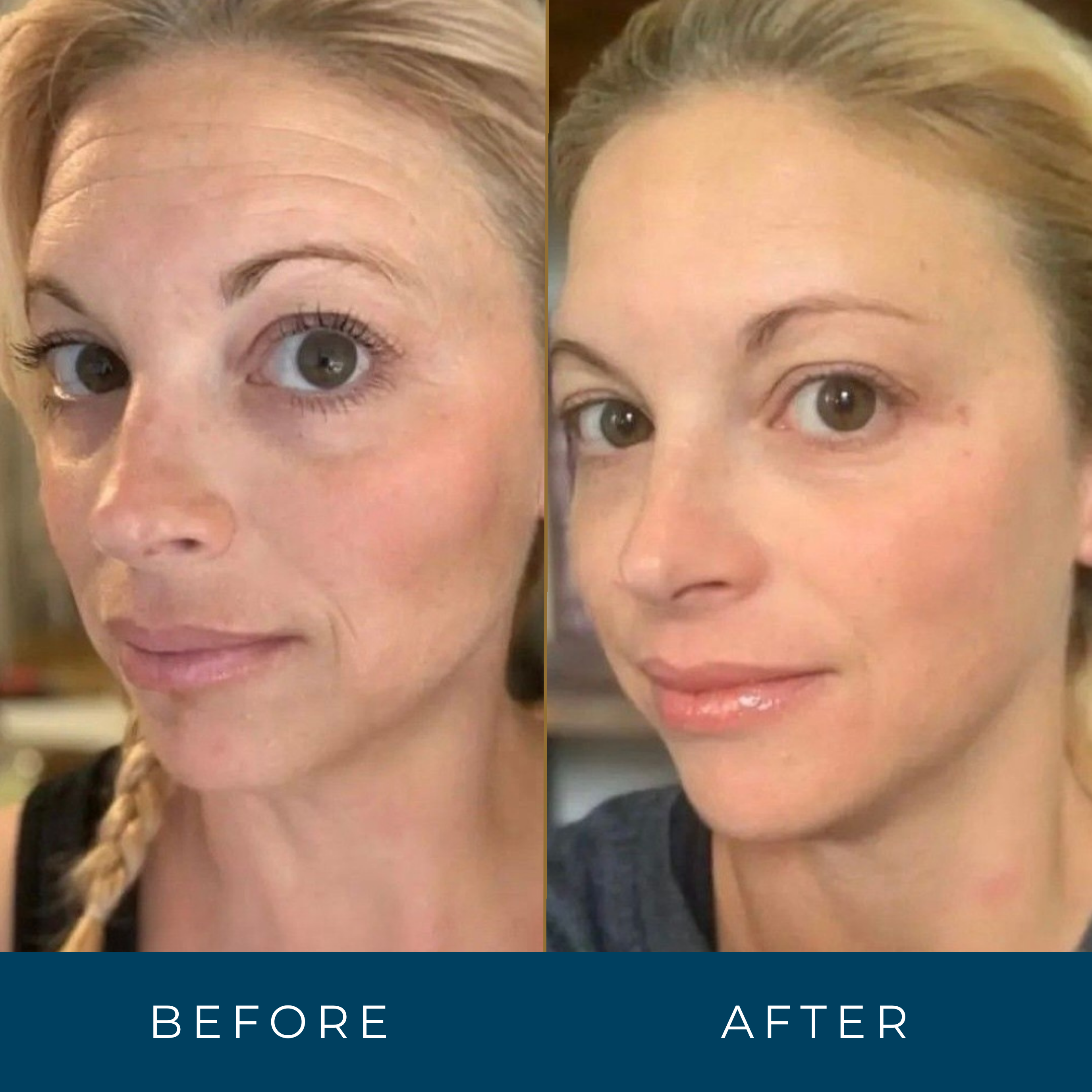 Retinal Face Serum Anti-Aging Vitamin A Wrinkle Reducer