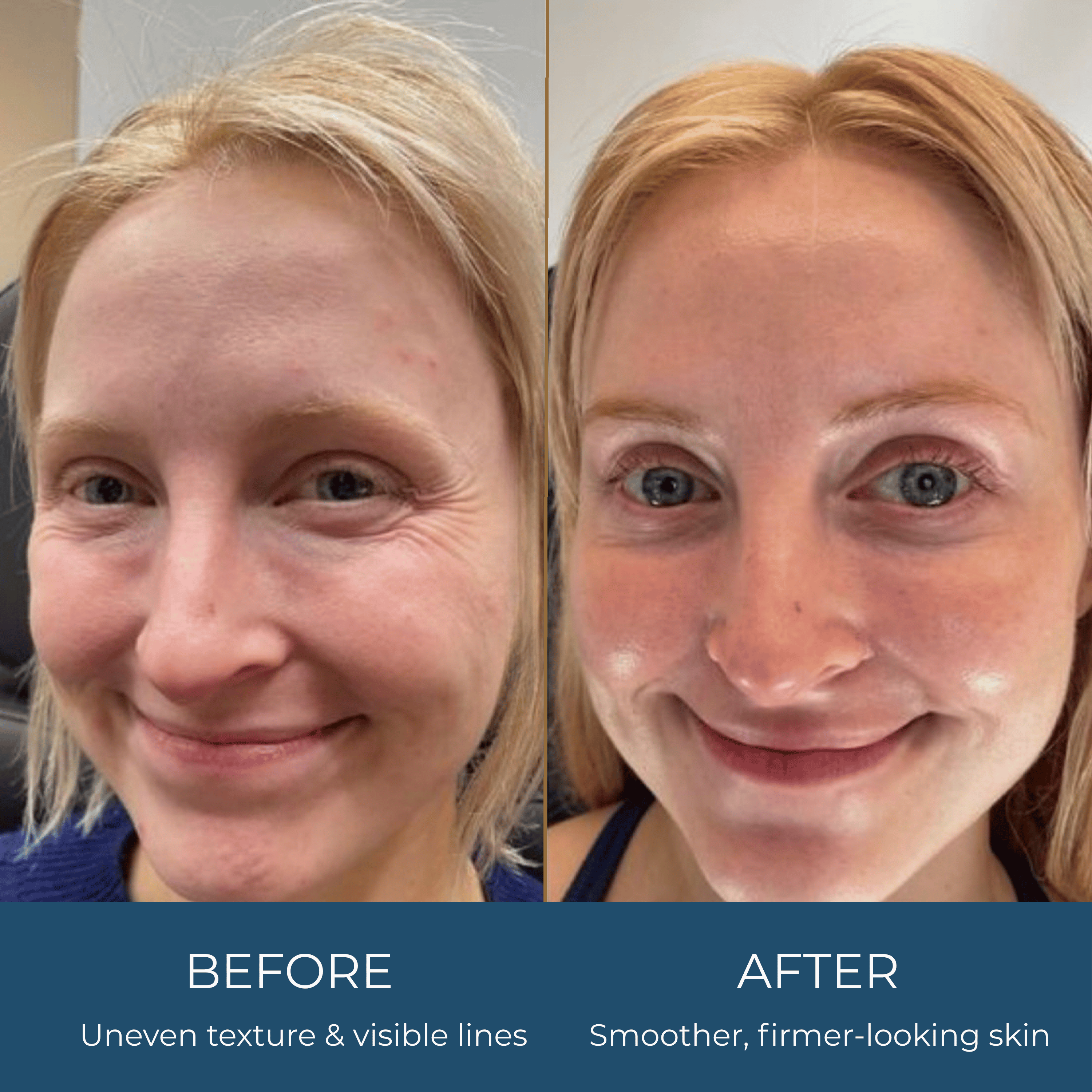 Collagen Lifting Cream Serum Anti-Aging Firming