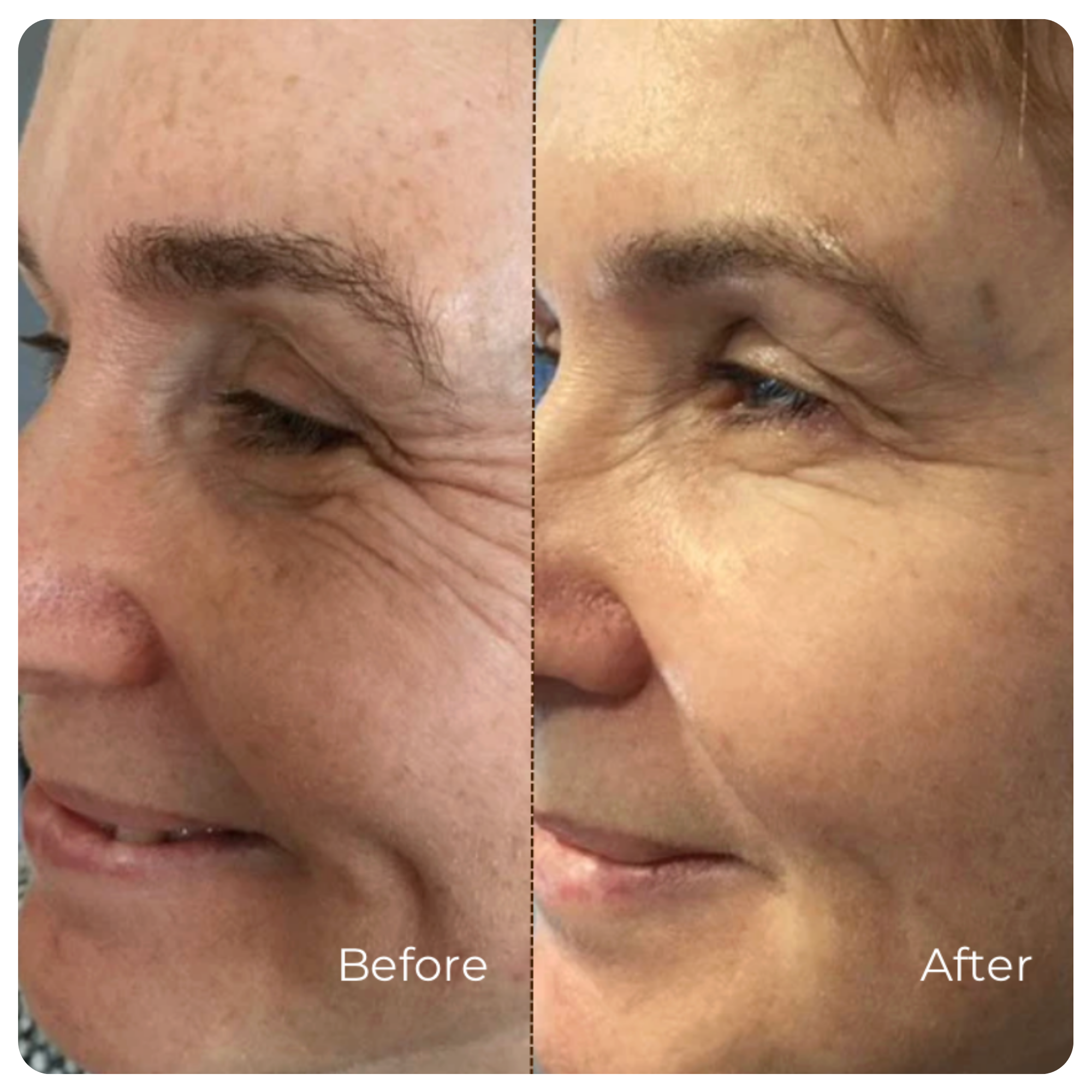 Collagen Serum Wrinkle Smoothing Anti-Aging Face Treatment