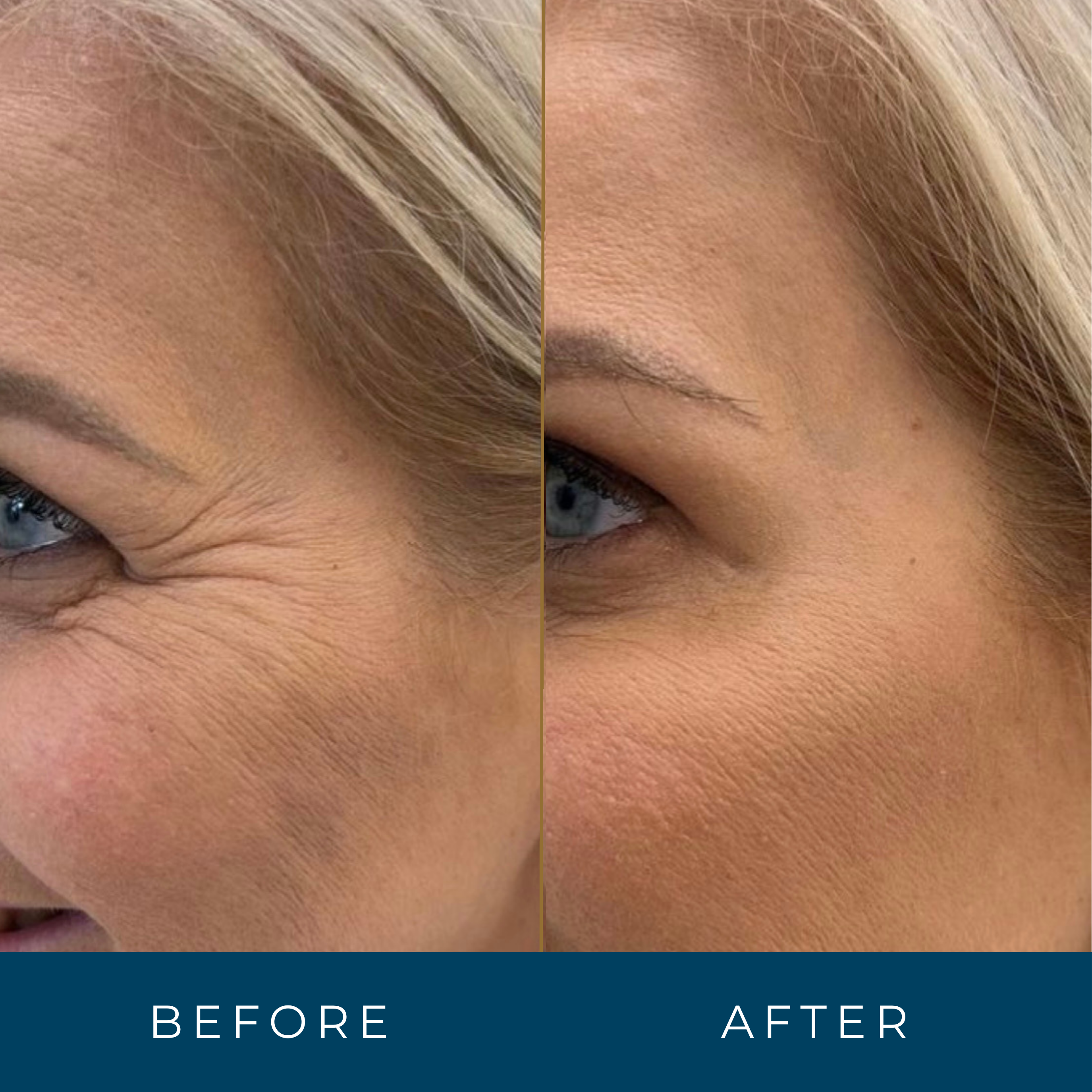 Retinal Face Serum Anti-Aging Vitamin A Wrinkle Reducer