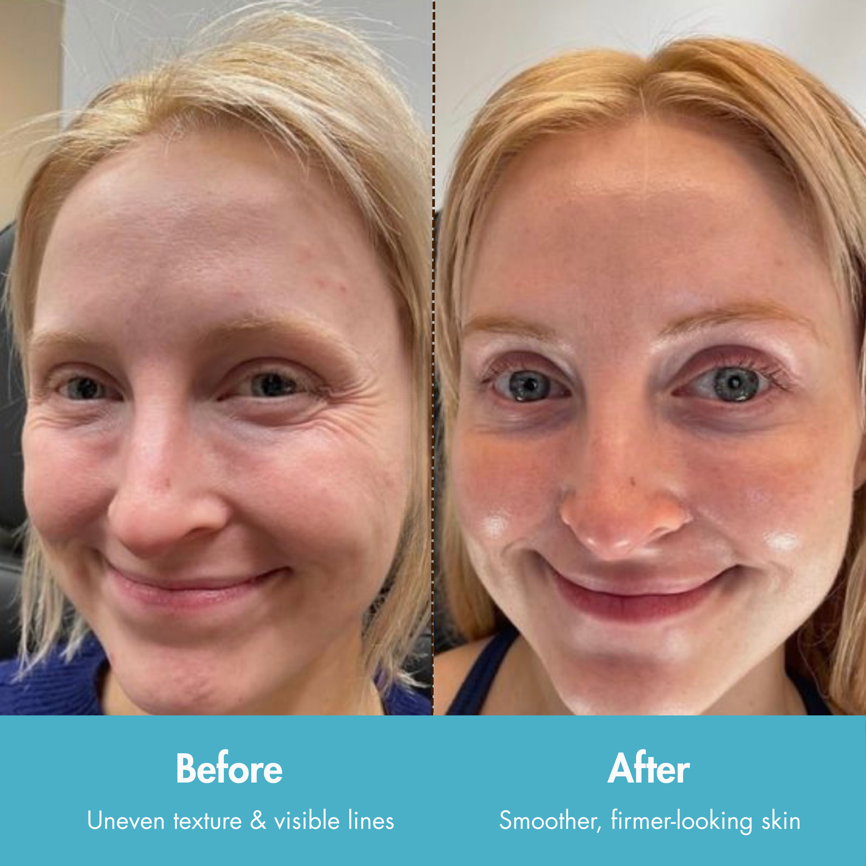 AlpaSkin™ Collagen Lift Cream-Serum