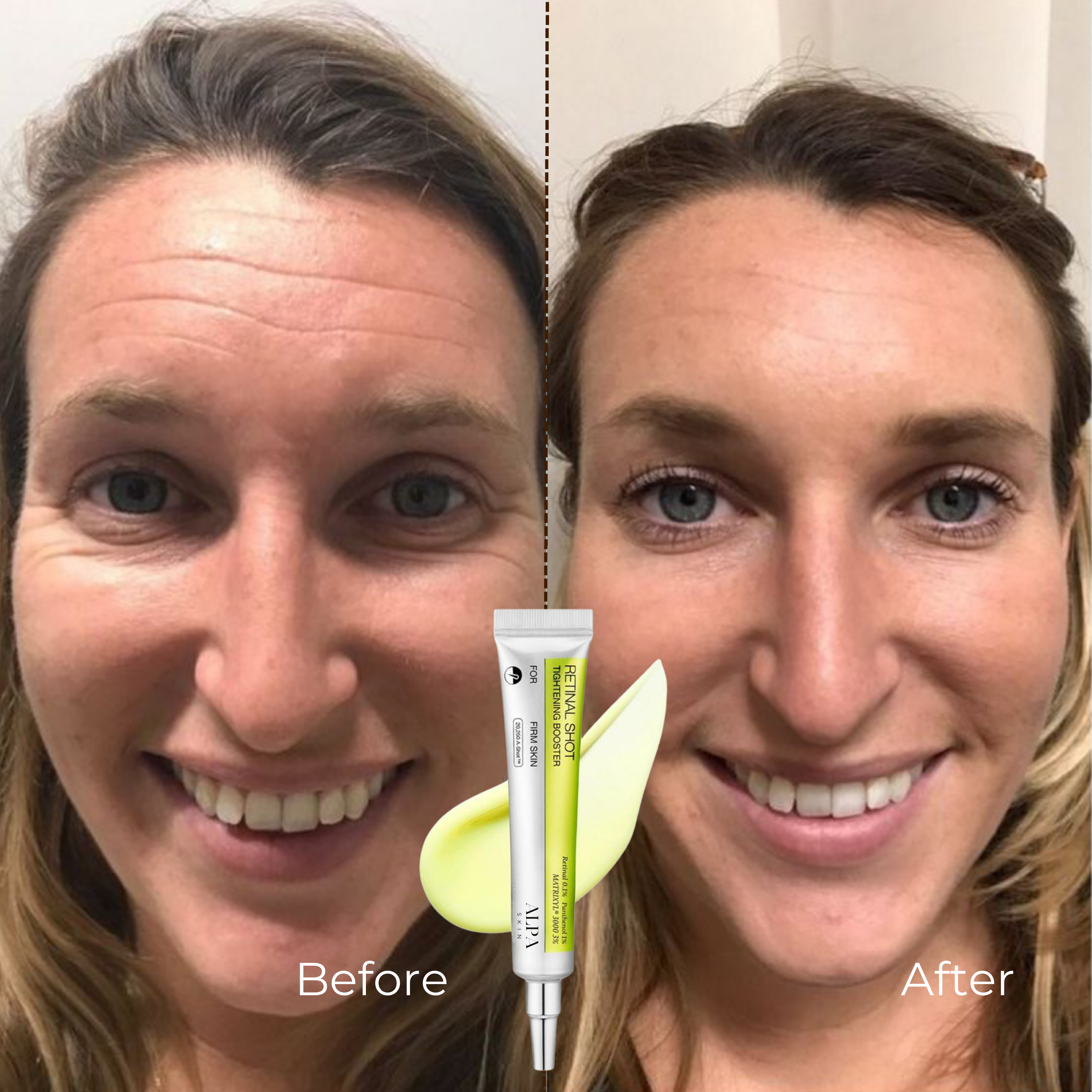 AlpaSkin™ Vita-A Retinal Shot